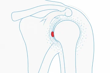 ozonoterapia post operatoria, Studio Ierna Roma EUR